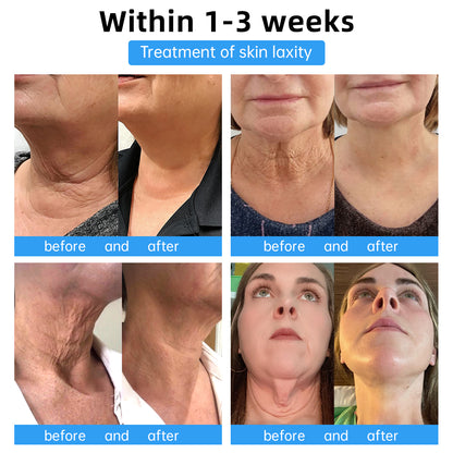 💧🪼𝐋𝐚𝐬𝐭 𝐃𝐚𝐲 𝐃𝐢𝐬𝐜𝐨𝐮𝐧𝐭: 𝟕5% 𝐎𝐅𝐅🫧Fubsta™ Advanced Firming & Wrinkle-Reducing Cream: Restore Skin Elasticity🌐