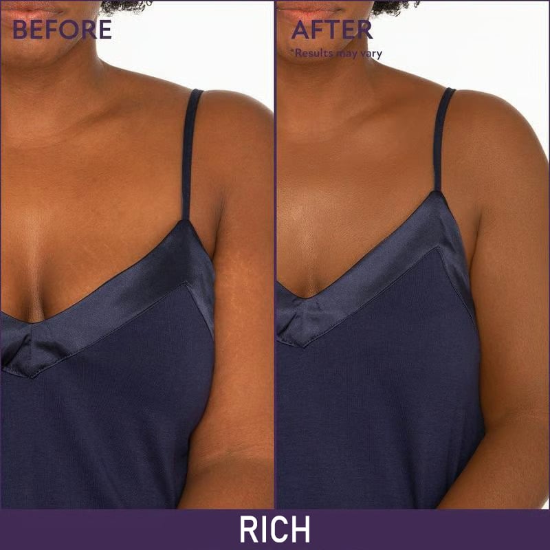 🔥 Final Hours! Save 78% on Soft Matte Cream Concealer + FREE Brush – Limited Stock: 58 Sets Remaining!