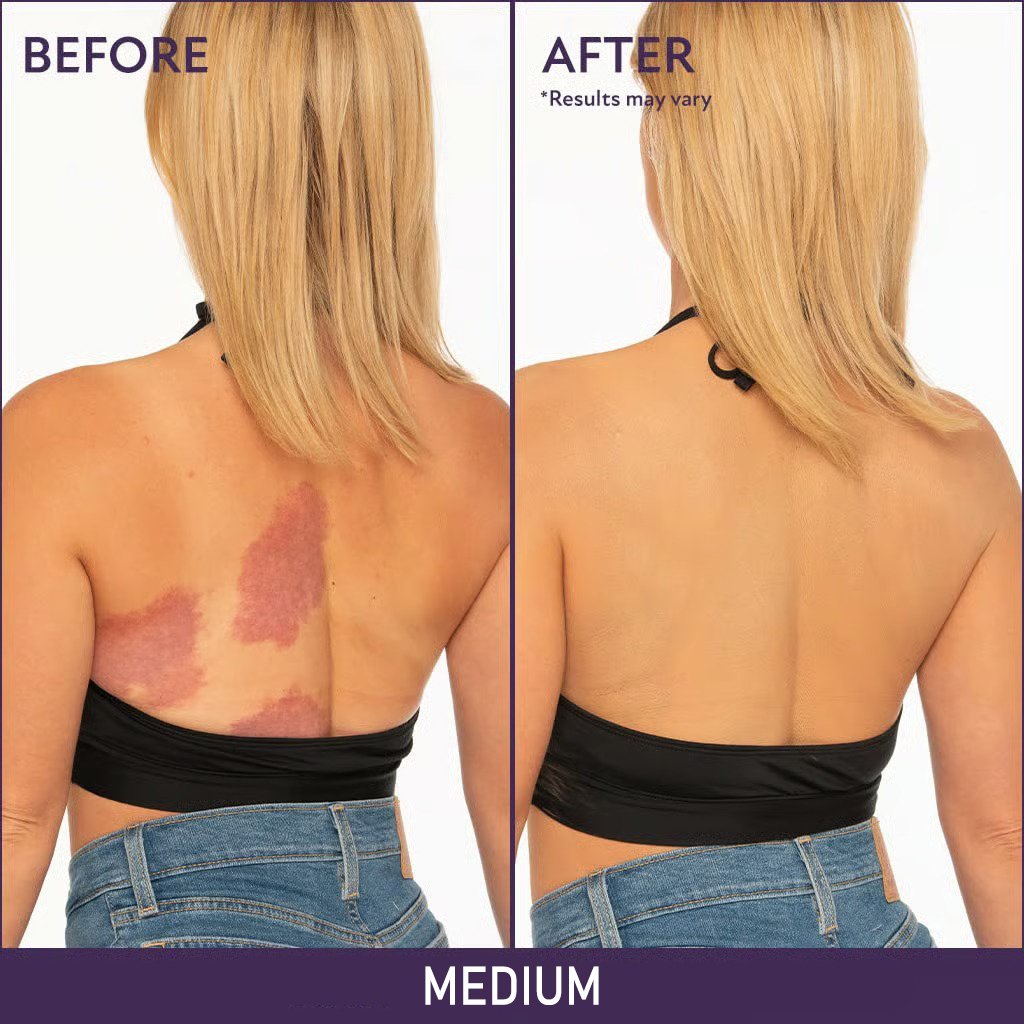 🔥 Final Hours! Save 78% on Soft Matte Cream Concealer + FREE Brush – Limited Stock: 58 Sets Remaining!