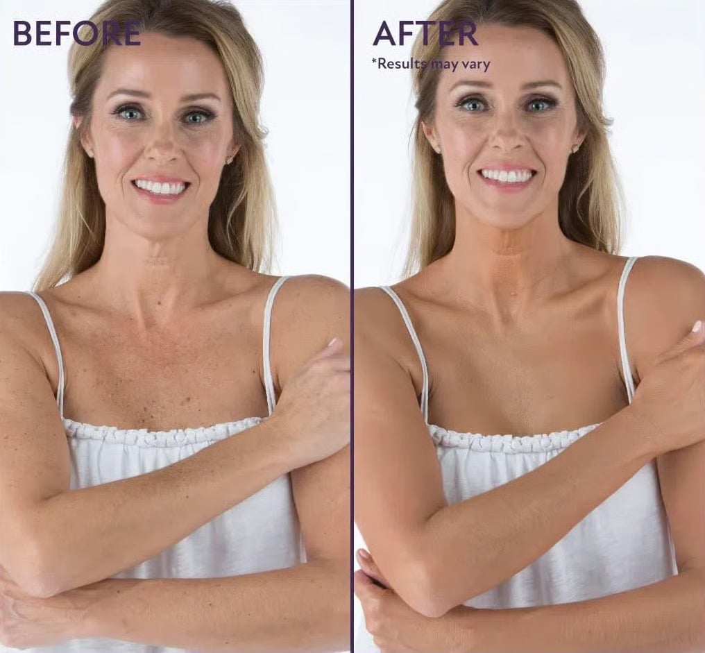 🔥 Final Hours! Save 78% on Soft Matte Cream Concealer + FREE Brush – Limited Stock: 58 Sets Remaining!