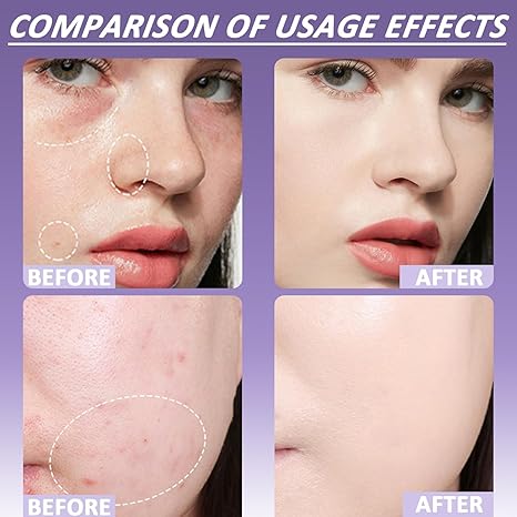 🔥 Final Hours! Save 78% on Soft Matte Cream Concealer + FREE Brush – Limited Stock: 58 Sets Remaining!