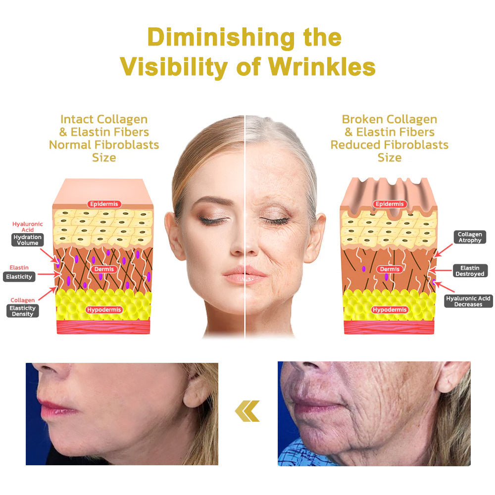 💧🪼𝐋𝐚𝐬𝐭 𝐃𝐚𝐲 𝐃𝐢𝐬𝐜𝐨𝐮𝐧𝐭: 𝟕5% 𝐎𝐅𝐅🫧Fubsta™ Advanced Firming & Wrinkle-Reducing Cream: Restore Skin Elasticity🌐